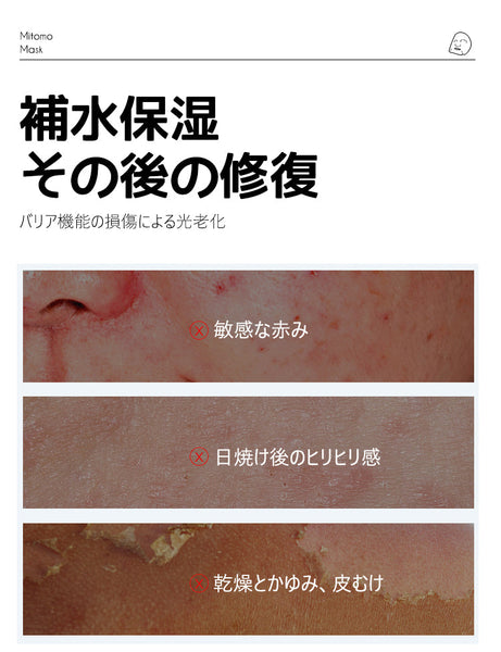 透明感ケア/美友フェイスマスクBR パール＆リンゴ配合 35枚入り【MTSA00505-E-2】