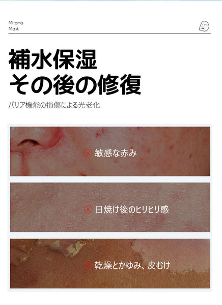 毛穴＆透明感ケア/美友フェイスマスクPO 竹炭×レチノール配合 35枚【MTSA00505-E-3】